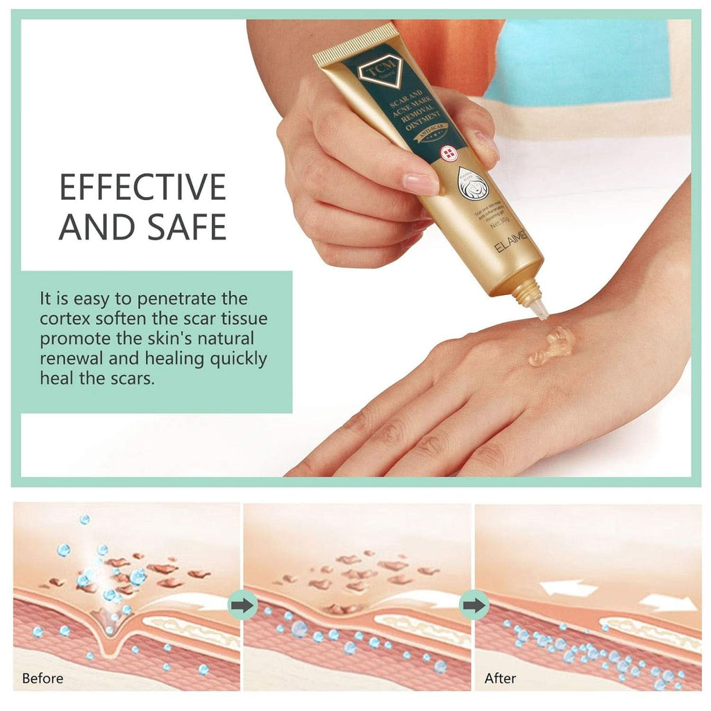 Gel pentru cicatrici, 30g Cosmetice si Infrumusetare Naty Shop