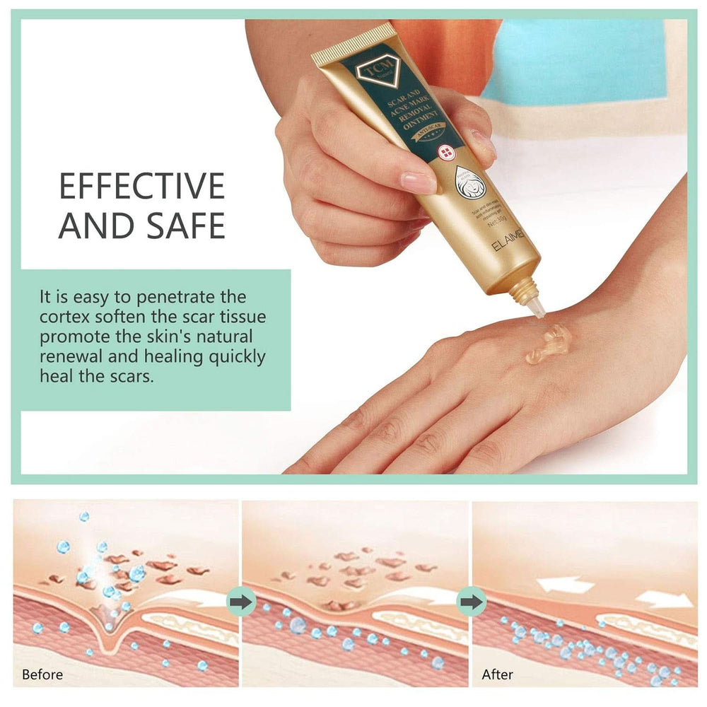 Gel pentru cicatrici, 30g Cosmetice si Infrumusetare Naty Shop