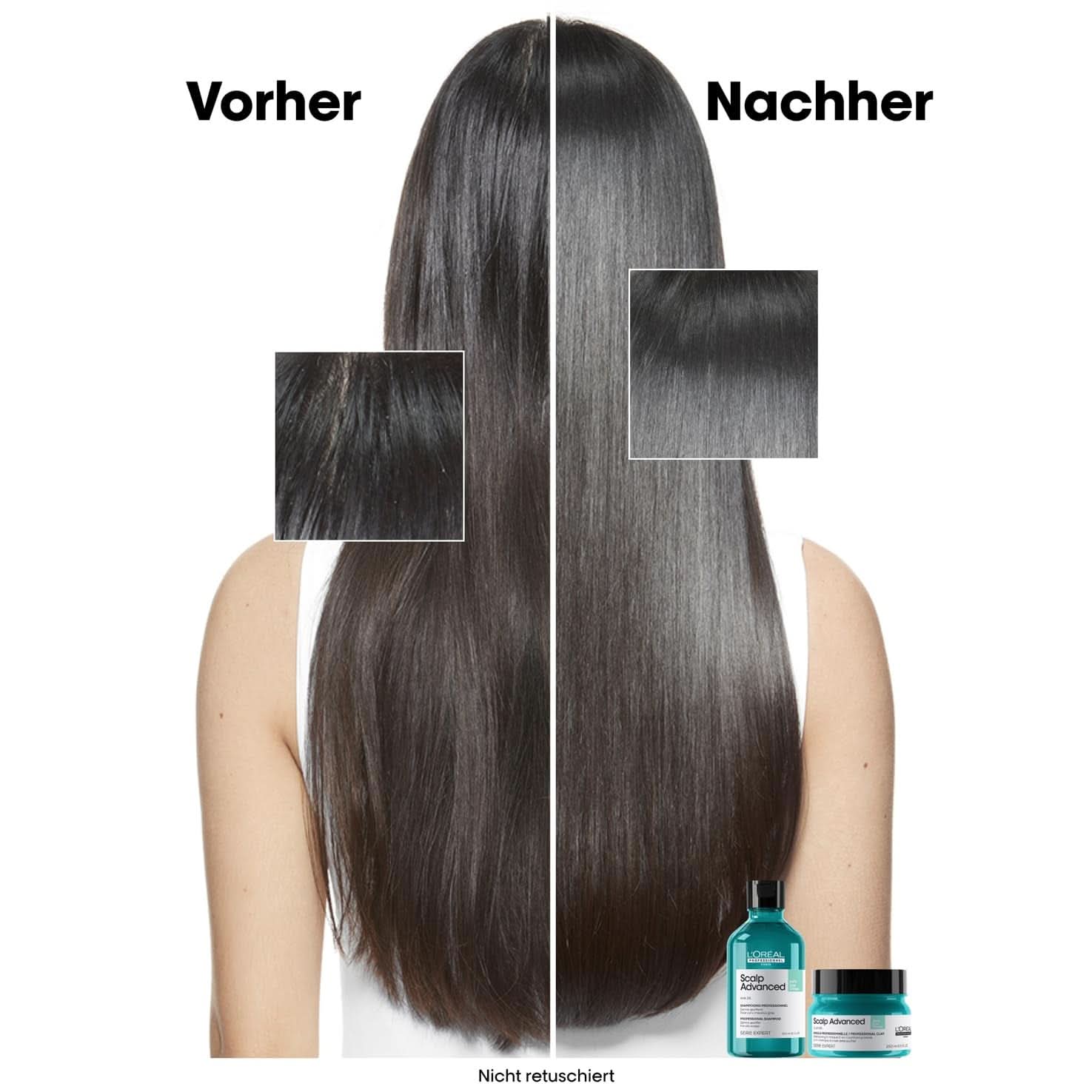 Shampoo detergente per cuoio capelluto grasso L'Oréal Professionnel, 300 ml Naty Shop Doccia e bagno