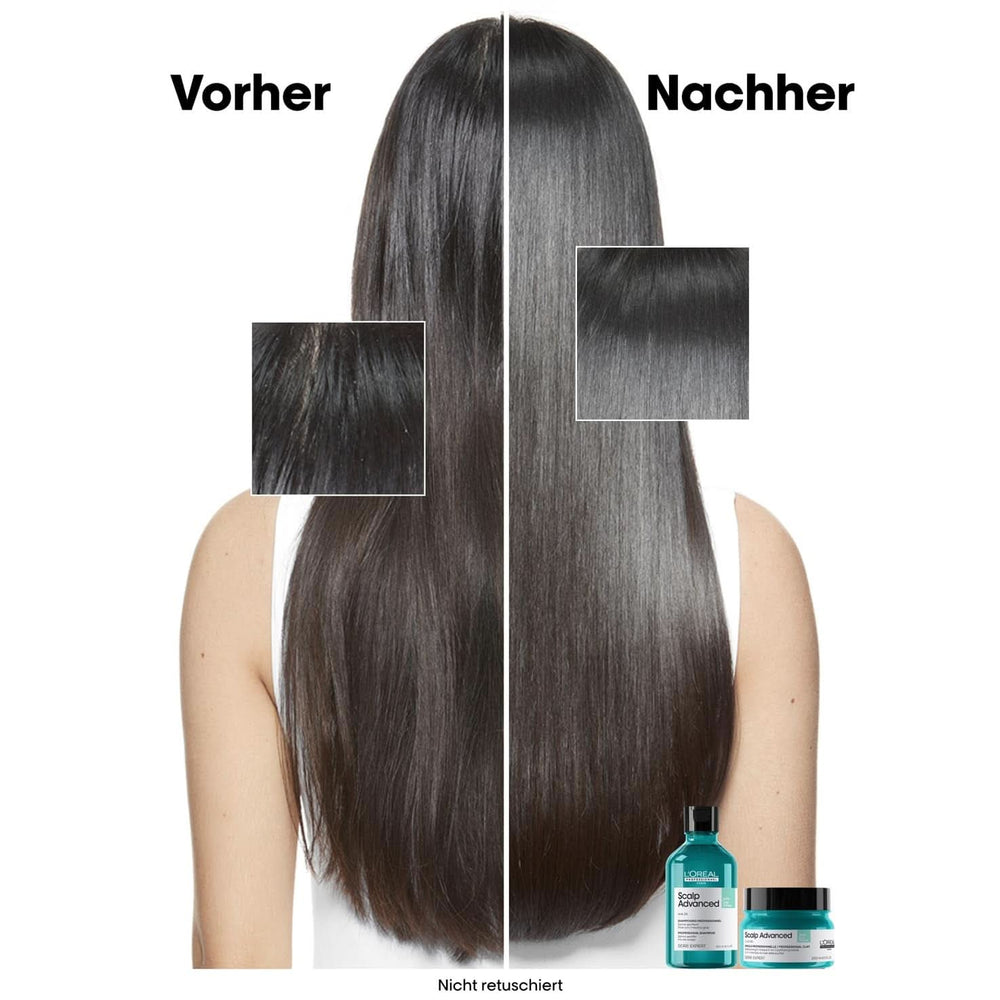 Shampoo detergente per cuoio capelluto grasso L'Oréal Professionnel, 300 ml Naty Shop Doccia e bagno