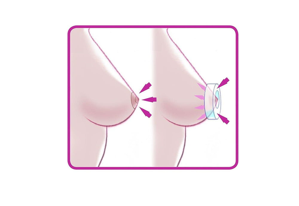 ELANEE Brust-Ringe, Schutz Der Brustwarze Bh-Kontakt Durch Hohllagerung, Ideal Bei Wunden, Entzündeten Brustwarzen Durch Stillen, 10 Stück (222-00) Accessori Alimentazione e Allattamento Bebe Naty Shop