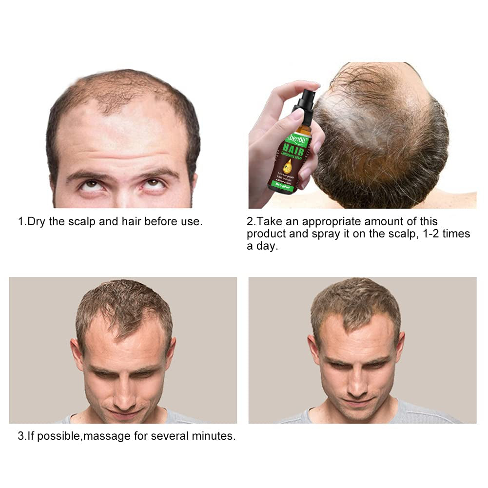 Creșterea părului, anti-căderea părului, spray de creștere a părului, căderea părului și tratamentul părului, pentru subțierea părului, promovează părul mai gros, mai plin și cu creștere mai rapidă, 60ml Ingrijirea parului Naty Shop