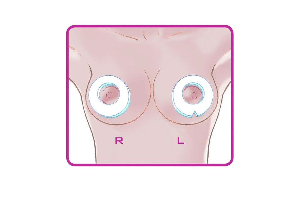 ELANEE Brust-Ringe, Schutz Der Brustwarze Bh-Kontakt Durch Hohllagerung, Ideal Bei Wunden, Entzündeten Brustwarzen Durch Stillen, 10 Stück (222-00) Accessori Alimentazione e Allattamento Bebe Naty Shop