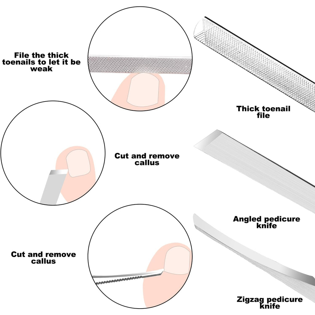 7-Teiliges Set Mit Feilen Und Hebern Für Eingewachsene Zehennägel, Set Aus Edelstahl Zum Entfernen Eingewachsener Zehennägel, Nagelreiniger Für Die Unternagelpflege, Pediküre-Werkzeuge
