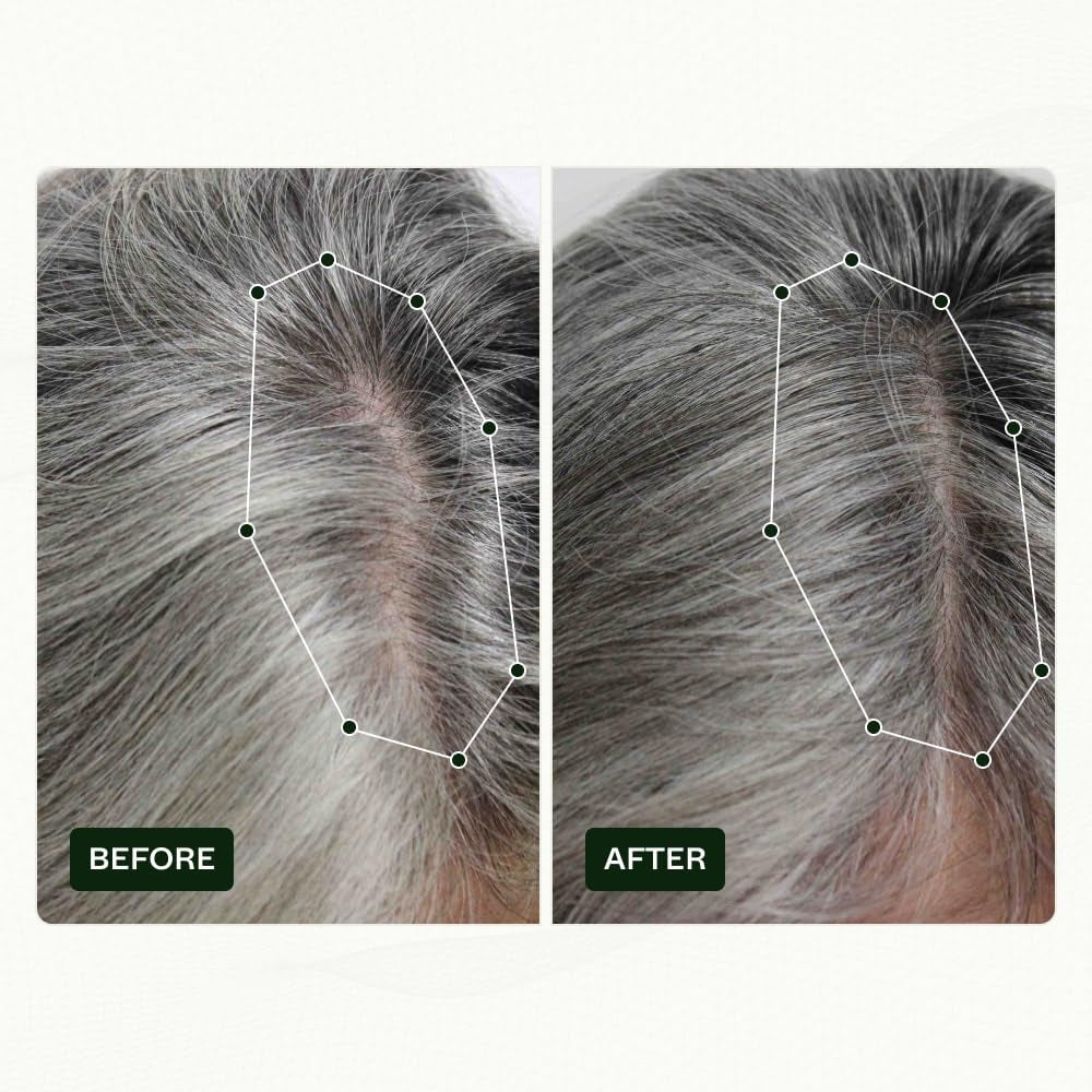 Scandinavian Biolabs Hair Growth Routine pentru femei cu rezultate dovedite clinic în 45 de zile | Tratamentul pentru căderea părului (Bio-Pilixin) Ingrijirea parului Naty Shop