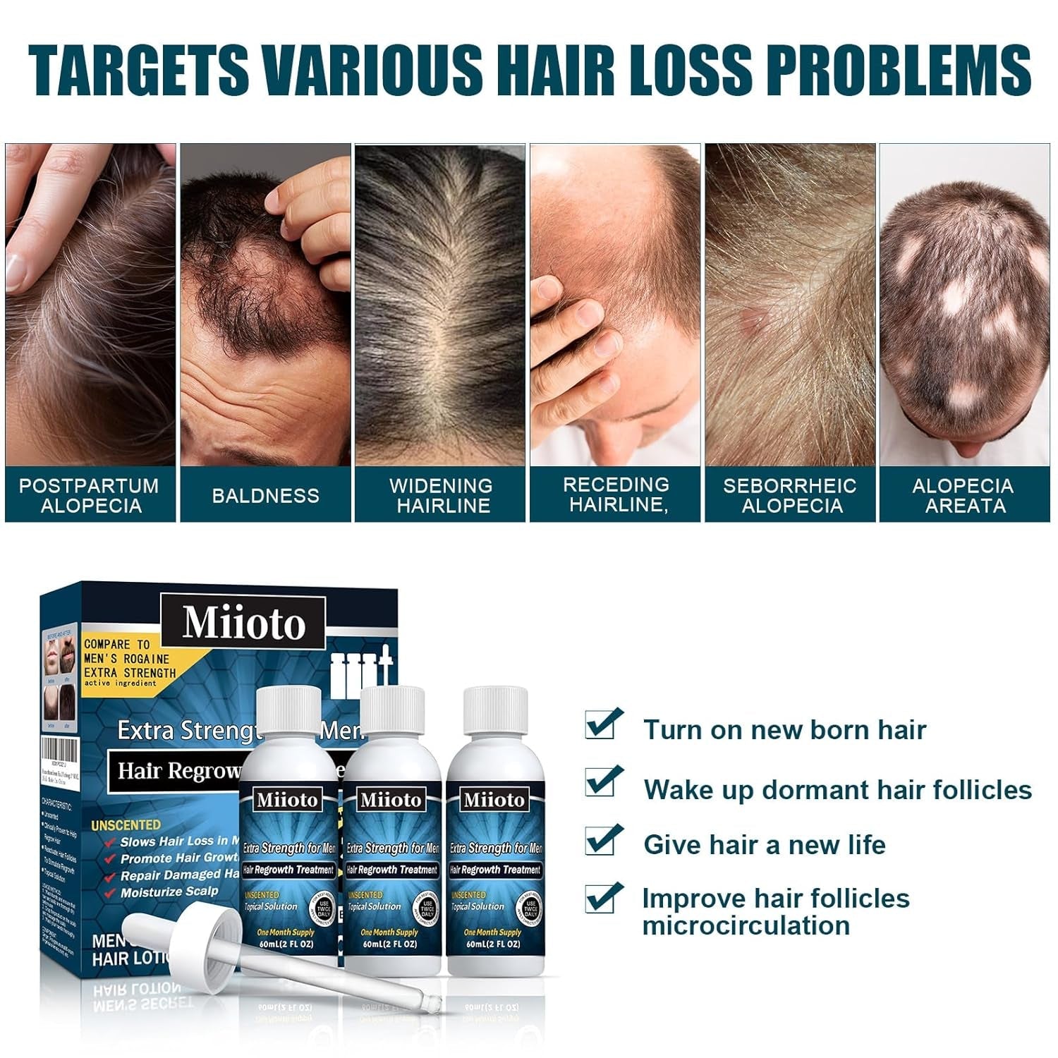 Miioto Hair Growth Serum, 180 ML Produs de creștere a părului pentru bărbați, ser de păr pentru creșterea părului, îngrijirea scalpului Promovează părul mai gros Hrănește scalpul și previne căderea părului Ingrijirea parului Naty Shop