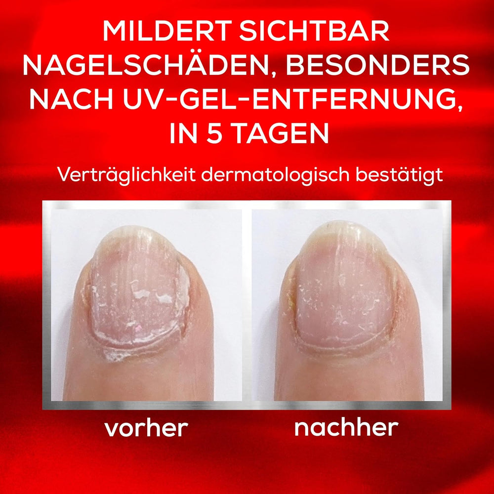 Essie Nail Rescue Kit: olio per unghie e cuticole profumato all'albicocca + smalto per unghie To the Rescue Repair