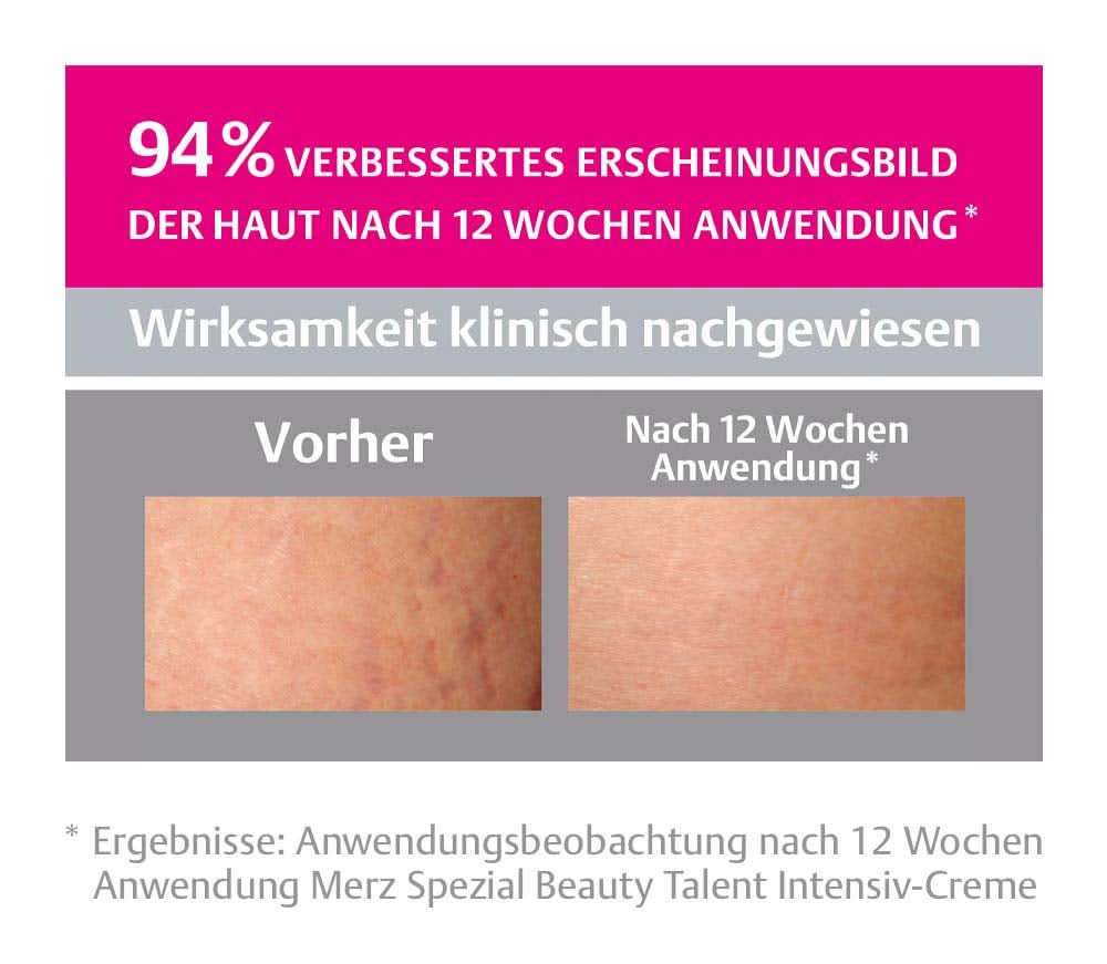 Merz Spezial, Crema intensiva antismagliature, 75 ml Cosmetici e Beauty Naty Shop
